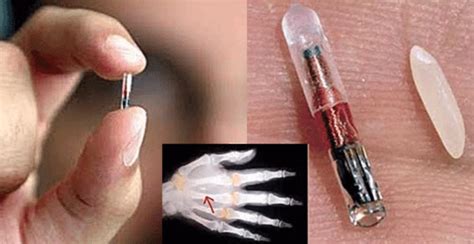 will americans get microchips